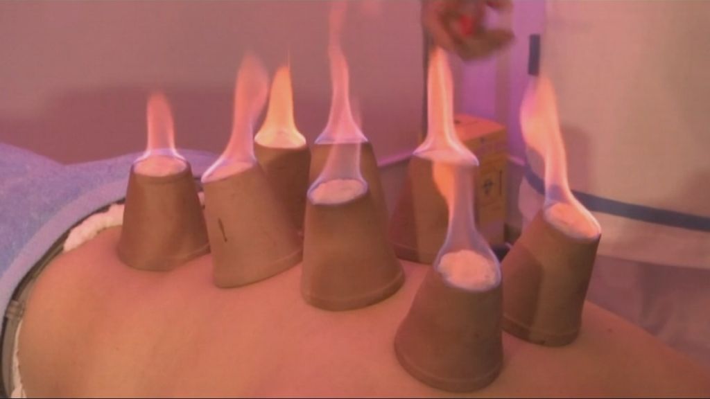 مدلك مصري يستخدم النار لتخفيف آلام العضلات 1 مدلك مصري يستخدم النار لتخفيف آلام العضلات