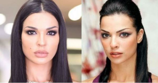 مشاهير غيرت عمليات التجميل ملامحهم وحياتهم