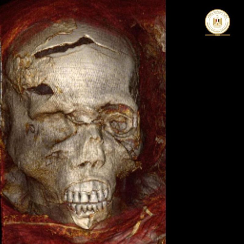 زاهي حواس يكشف ملابسات مقتل الملك الفرعوني سقنن رع على يد الهكسوس قبل نحو 3600 عام 2 زاهي حواس يكشف ملابسات مقتل الملك الفرعوني سقنن رع على يد الهكسوس قبل نحو 3600 عام