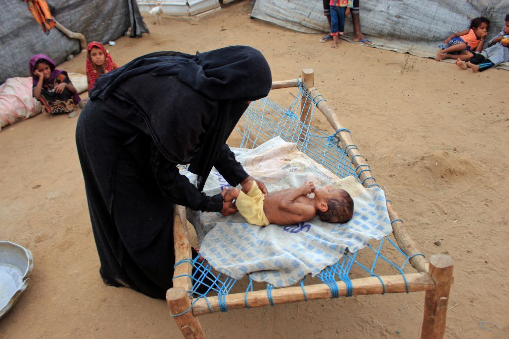 موت "الملايين" بسبب المجاعات والأمين العام للأمم المتحدة يحذر