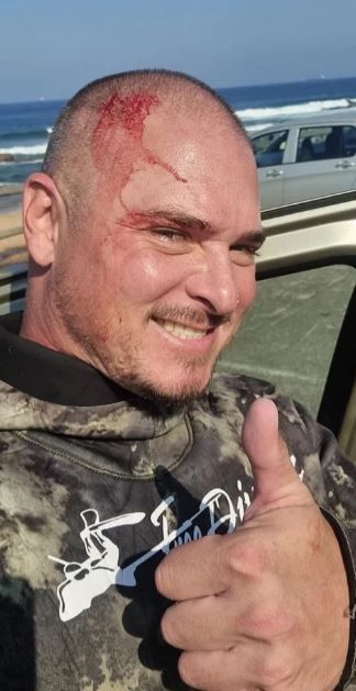 غواص يجد سن سمكة قرش في رأسه في جنوب أفريقيا 1 غواص يجد سن سمكة قرش في رأسه في جنوب أفريقيا