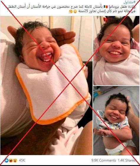 ما قصة الطفلة الرضيعة التي ولدت بأسنان كاملة؟ 1 ما قصة الطفلة الرضيعة التي ولدت بأسنان كاملة؟