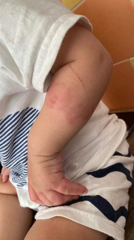 الأردن.. تعرض طفل للإيذاء في إحدى الحضانات يثير عاصفة من الانتقادات 1 الأردن.. تعرض طفل للإيذاء في إحدى الحضانات يثير عاصفة من الانتقادات