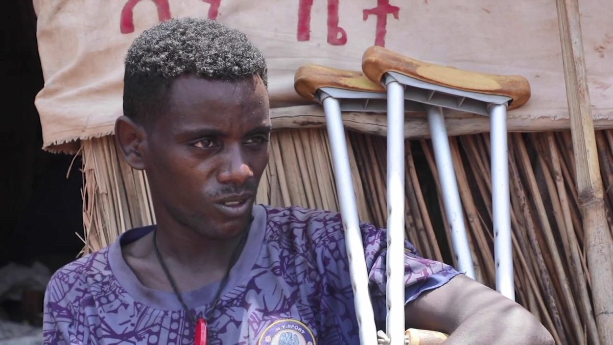 تفش مقلق لالتهاب الكبد الوبائي بين لاجئين إثيوبيين في السودان 1 الكبد الوبائي