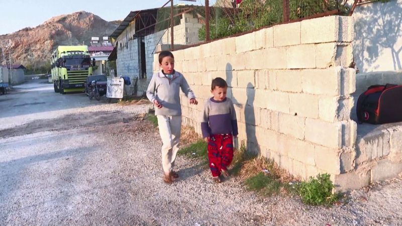 شيبلي عمر.. طفل مشوه في الحرب السورية يكافح من أجل حياة جديدة 3 طفل