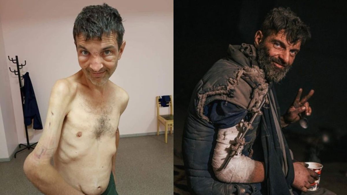 صور تبين الفرق بين معاملة روسيا الوحشية للأسرى ومعاملة أوكرانيا 2 روسيا