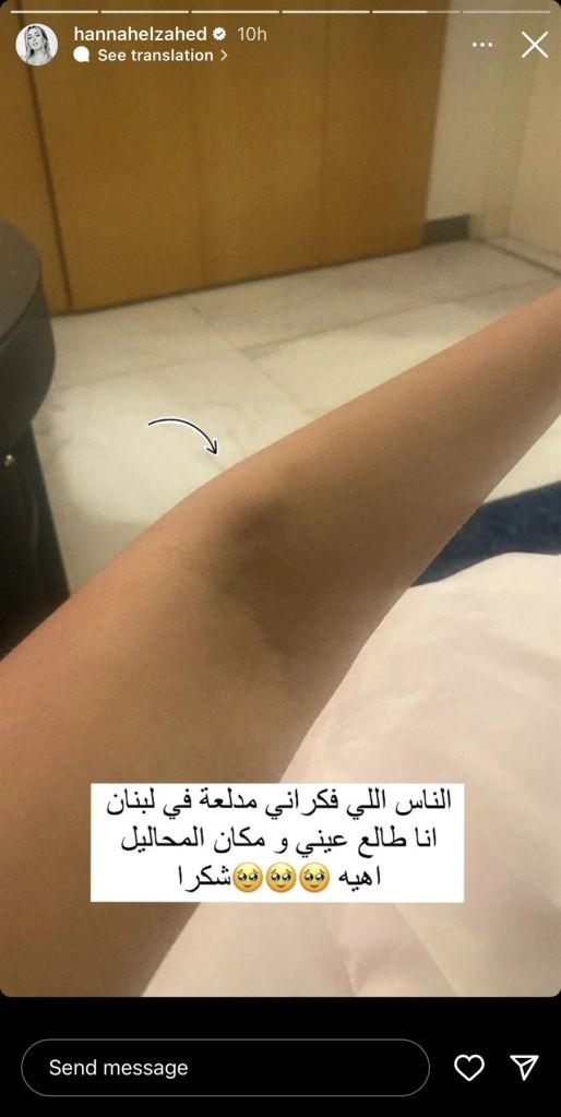 نبيلة عبيد تنفى إصابتها بالفيروس المخلوي وطلاق نسرين طافش