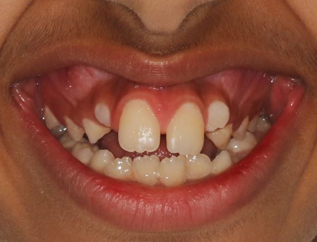 ما علاقة التنمر بتقويم الأسنان؟.. دكتور محمد صالح يجيب لـ"أخبار الآن"