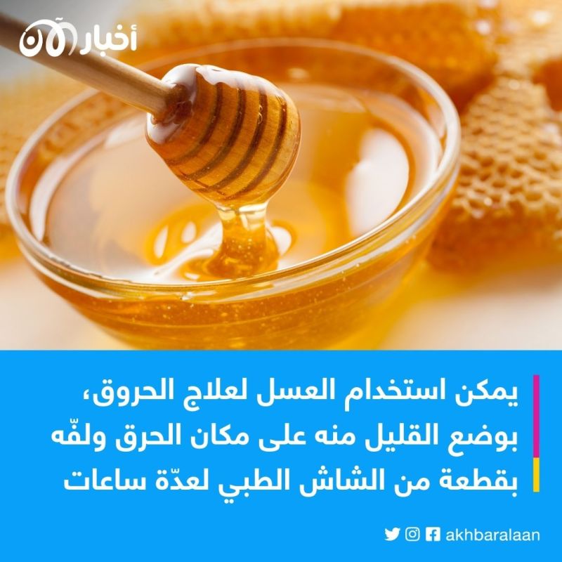 بأبسط المكونات.. كيف تعالج الحروق في المنزل قبل الذهاب للطبيب؟