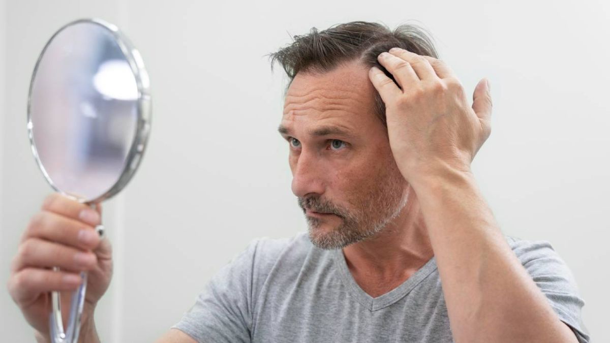 تساقط الشعر