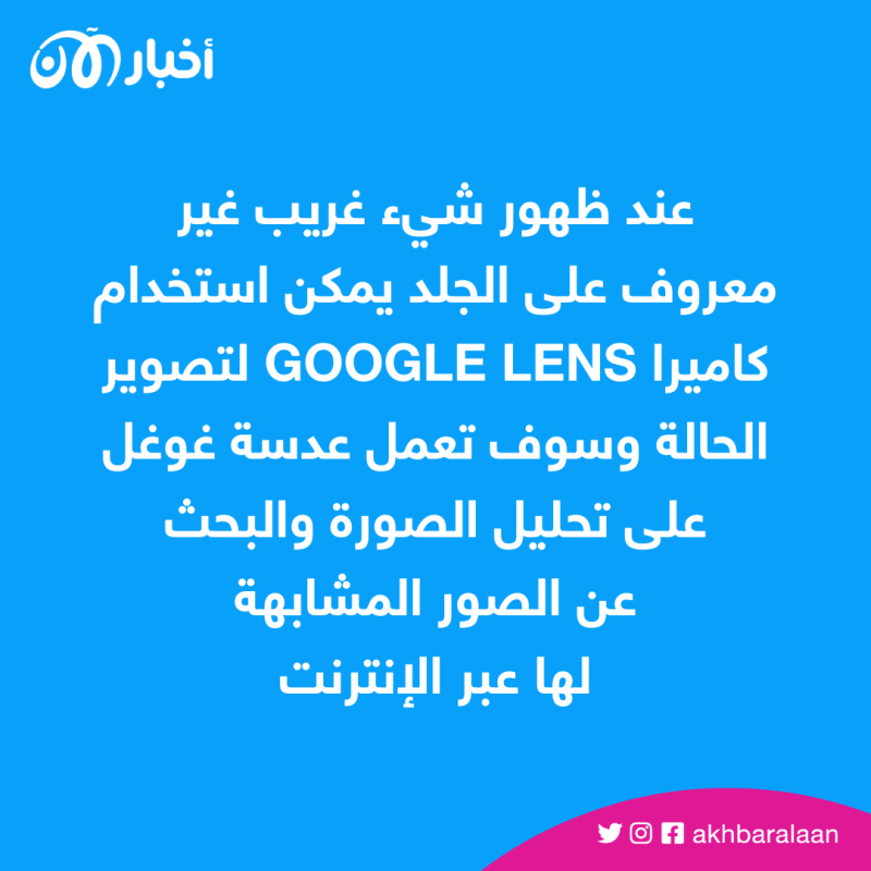 Google Lens تساعدك الآن على تشخيص الأمراض الجلدية