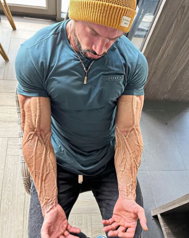 ما هو سبب وفاة بطل كمال الأجسام جو ليندنر؟ 4 ما هو سبب وفاة بطل كمال الأجسام جو ليندنر؟