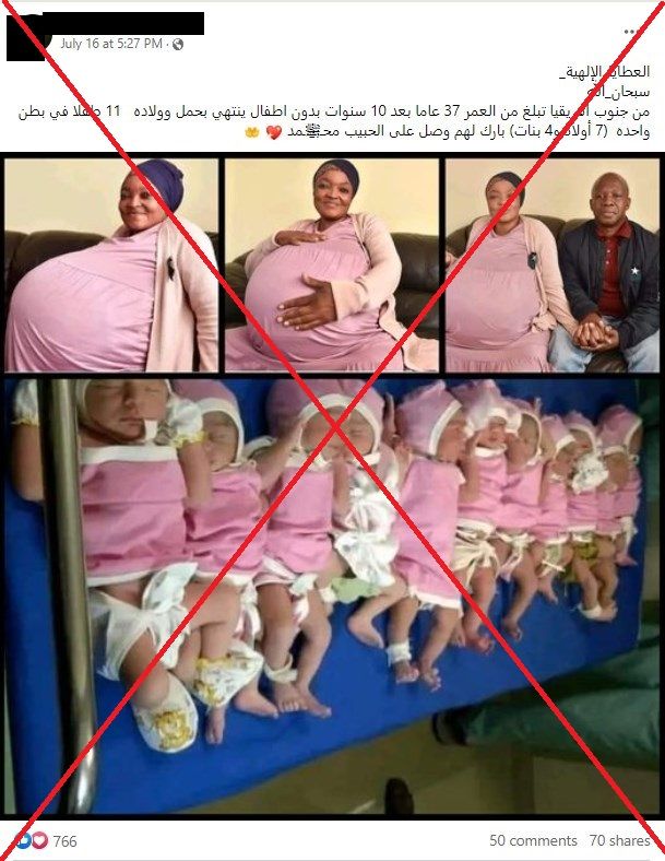 سيدة تنجب 11 توأمًا.. ما حقيقة الصورة التي أشعلت الإنترنت؟