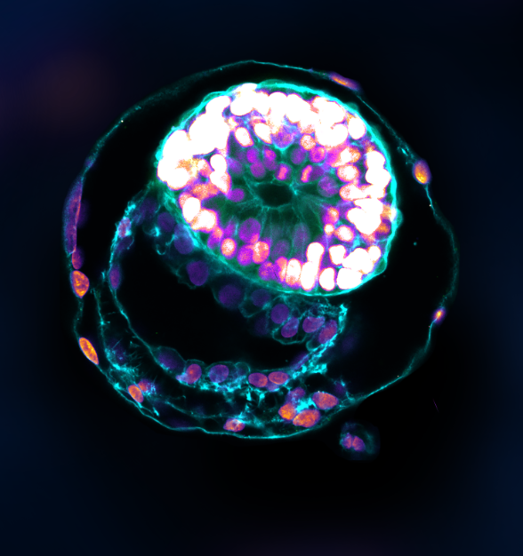 نجاح إنتاج "جنين بشري" دون بويضات أو حيوانات منوية.. "أخبار الآن" تكشف التفاصيل