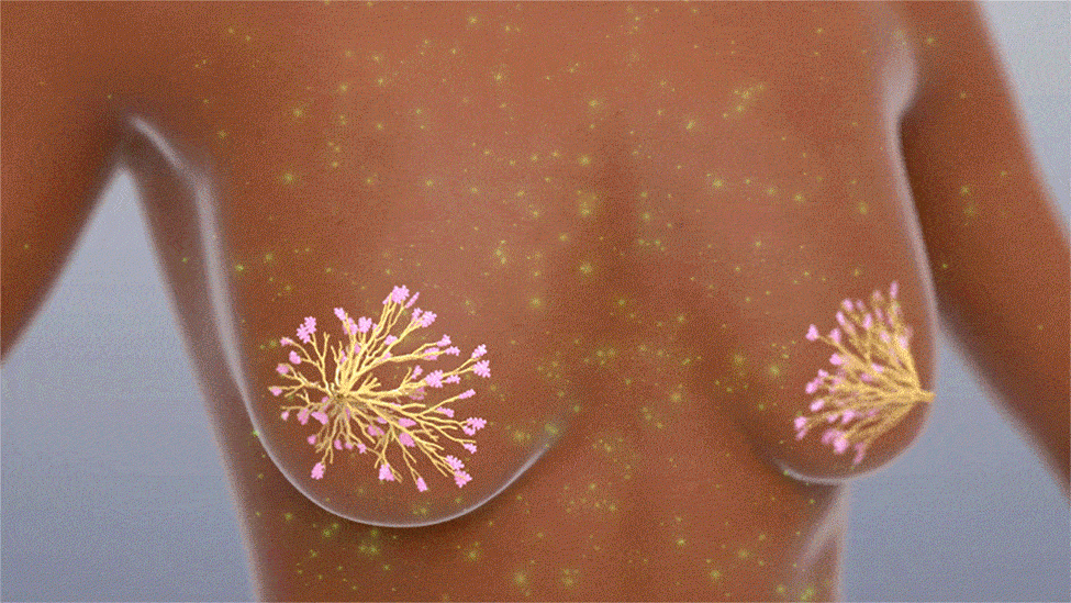 كيف كانت رحلة علاج أول مريضة تتلقى لقاح سرطان الثدي؟.. جينيفر ديفيس تُجيب 3 كيف كانت رحلة علاج أول مريضة تتلقى لقاح سرطان الثدي؟.. جينيفر ديفيس تُجيب