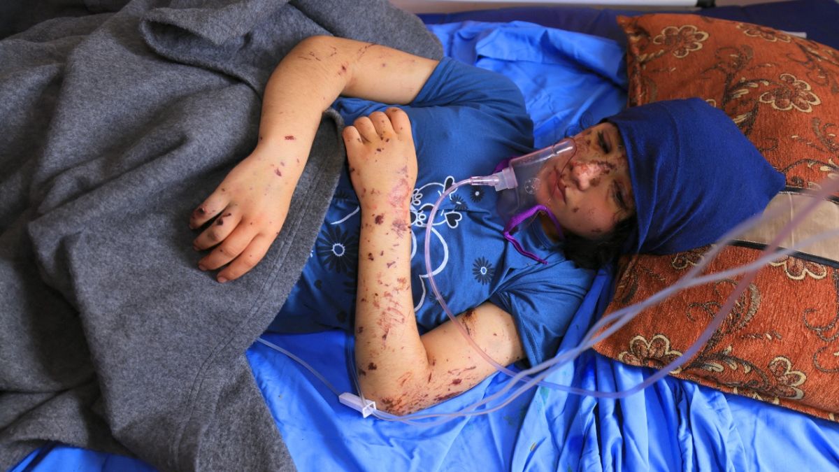 أطفال غزة.. فقدوا أقدامهم لكن لم يفقدوا أحلامهم.. مشاهد مؤثرة