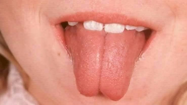 أسطورة أم حقيقة.. ماذا تعرف عن الإنسان الزهري؟